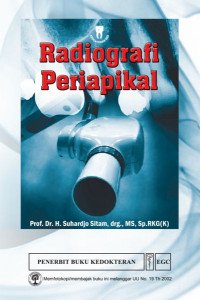 Image of Radiografi Periapikal