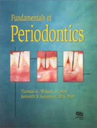 Image of Fundamentals of Periodontics