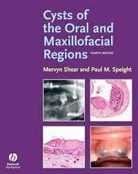 Image of Cysts of the Oral and Maxillofacial Regions