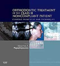 Image of Orthodontic Treatment of The Class II Noncompliant Patient