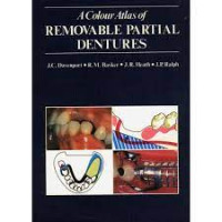 Image of A Colour Atlas of Removable Partial Dentures