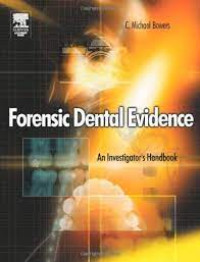 Image of Forensic Dental Evidence An Investigator's Handbook