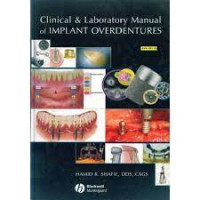 Image of Clinical & Laboratory Manual of Implant Overdentures