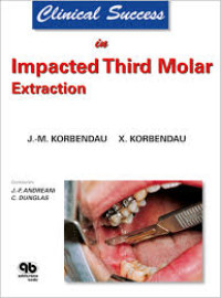 Image of Clinical Success In Implacted Third Molar Extraction