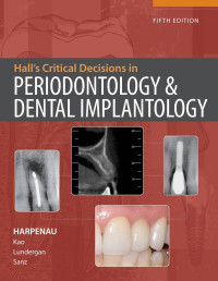 Image of Hall's Critical Decisions in Periodontology & Dental Implantology