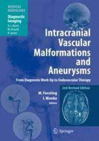 Image of Intracranial Vascular Malformations and Aneurysms