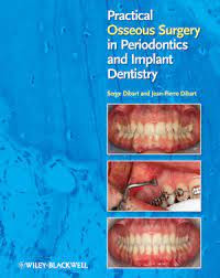 Image of Practical Osseous Surgery in Periodontics and Implant Dentistry