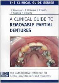 Image of A Clinical Guide to Removable Partial Dentures