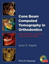 Image of Cone Beam Computed Tomography in Orthodontics Indications, Insights and Innovations