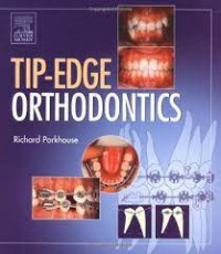 Image of Tip-Edge Orthodontics
