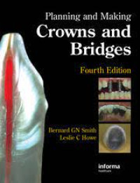 Image of Planning and Making Crowns and Bridges