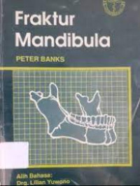 Image of Fraktur Mandibula