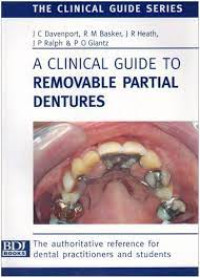 Image of A Clinical Guide to Removable Partial Dentures