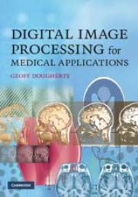 Image of Digital Image Processing for Medical Applicattions