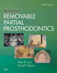 Image of McCracken's Removable Partial Prosthodontics