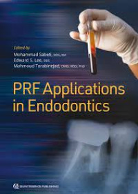 Image of Prf Applications in Endodontics