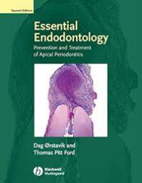 Image of Essential Endododntology